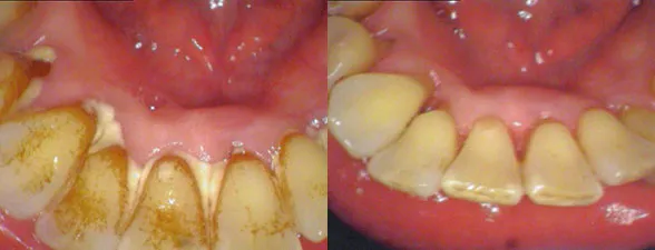 cleaning before and after photos
