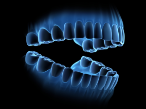 Digital X-Ray illustration