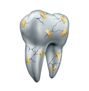 cracked tooth illustration