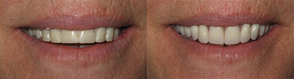 before and after gallery photo