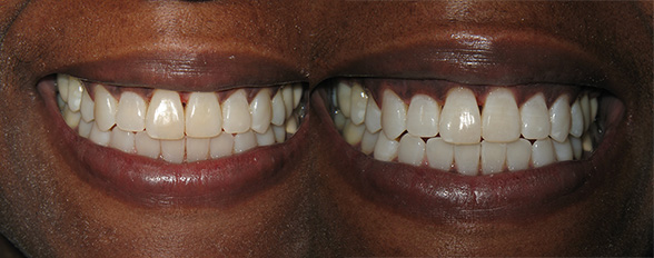 before and after gallery photo